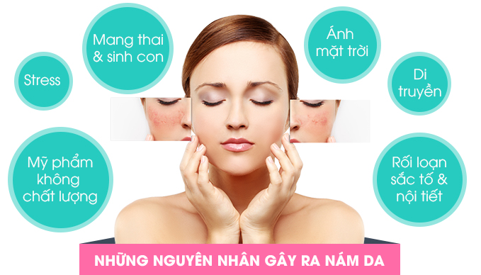 nhung_nguyen_nhan_gay_ra_nam_da